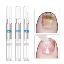 Load image into Gallery viewer, Herbal Nail Fungus Treatment Pen