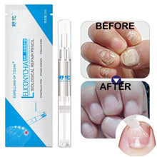 Load image into Gallery viewer, Herbal Nail Fungus Treatment Pen