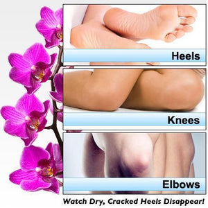 Heel Tastic Foot Repair Cream - 100 % Natural Formula