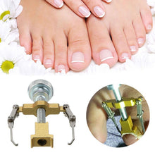 Load image into Gallery viewer, INGROWN NAIL CORRECTOR
